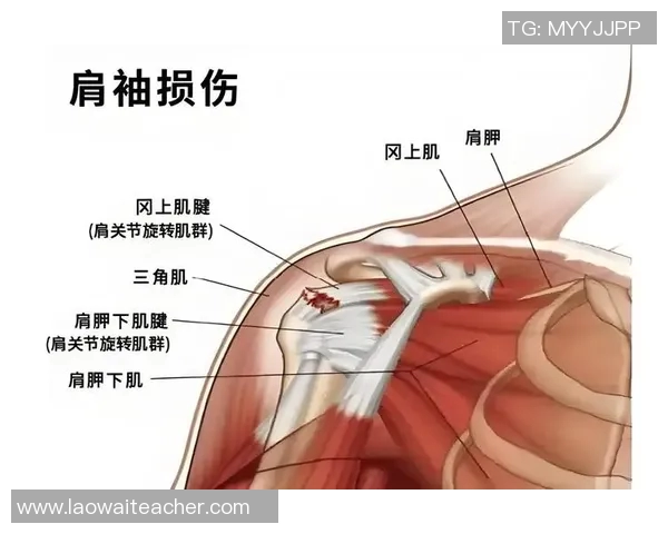 哑铃训练的肌肉群解析及其对身体塑形的全面影响
